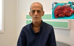 Böbrek ağrısıyla gitti, karnından 8 kiloluk tümör çıkarıldı